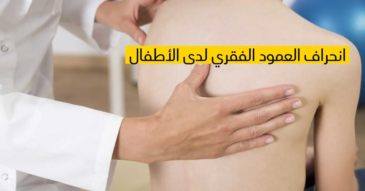 إنحراف العمود الفقري لدى الأطفال 